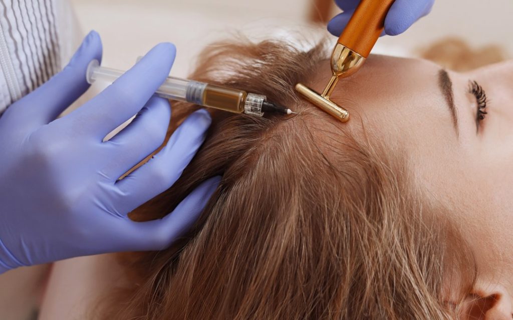 Mesoterapia Capilar